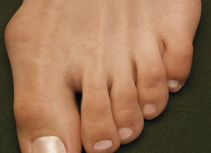 Bequeme Clogs aus Stretchmaterial mit elastischem Einschlupf 