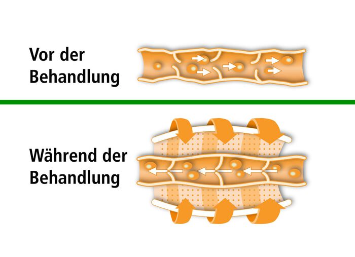 Beurer Venen-Massageger&auml;t FM 150 