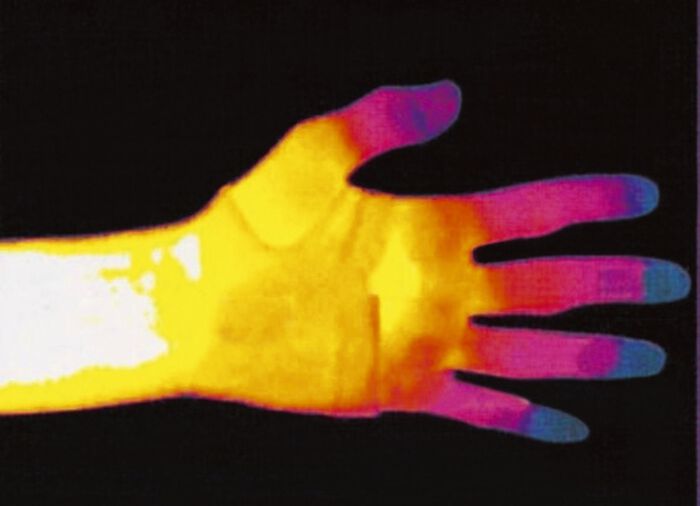 Bandagen in verschiedenen Ausführungen CREME